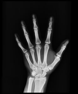does urgent care do x rays